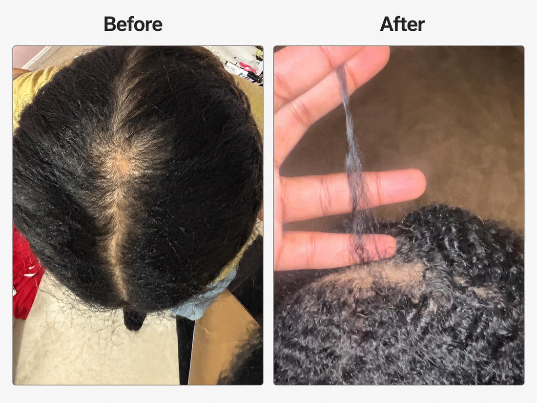Rosemary Oil for Edges and Thinning: What the Research Actually Says