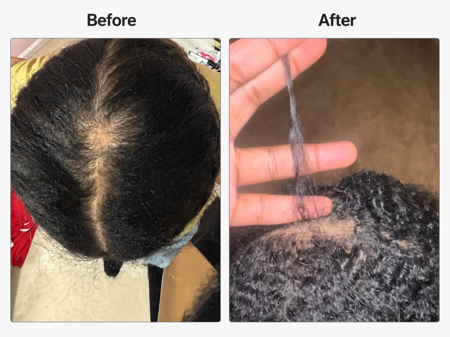 Crown Reserve Scalp Oil | 12-Herb Botanical for Density, Edges + Regrowth