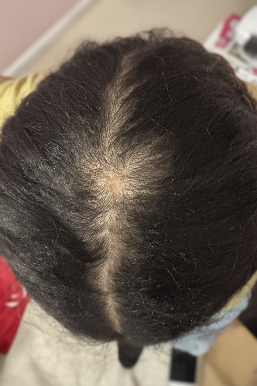 BEFORE